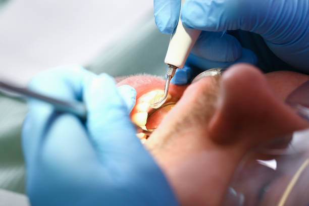 Best Emergency Dental Care for Trauma or Injury in Oxford, MI